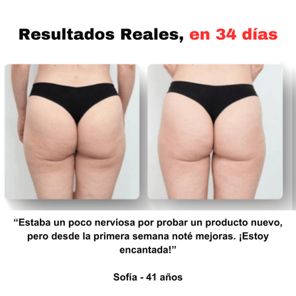 SmoothGlow™ - Masajeador anticelulítico